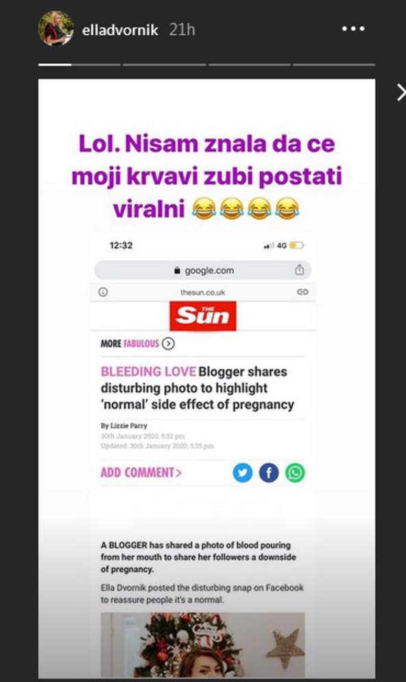 Ella Dvornik krvavom fotografijom uznemirila Britance