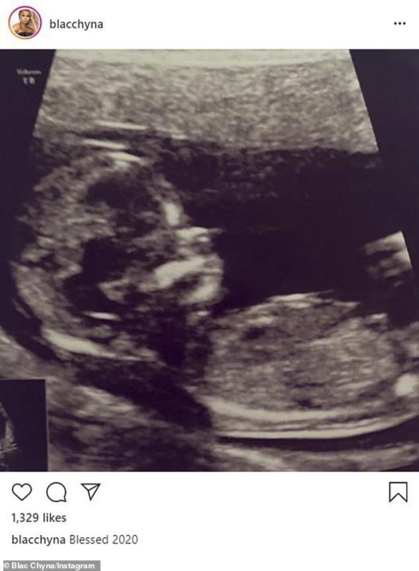 Nakon dvoje djece različitih očeva pohvalila se i trećim: 'Čije je sada?'