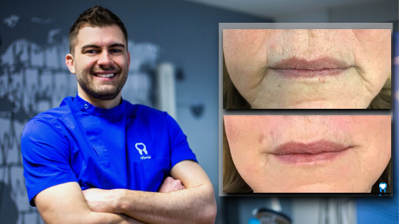 Kako se s jednim tretmanom pomladiti za više od 10 godina?