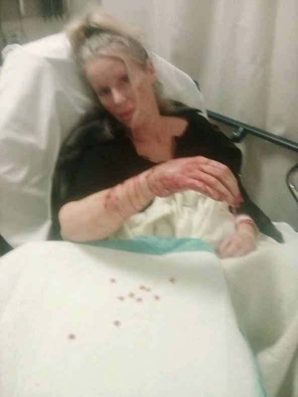 KRV JE ŠIKLJALA Playboyevu zečicu izgrizli njeni vlastiti pitbulli