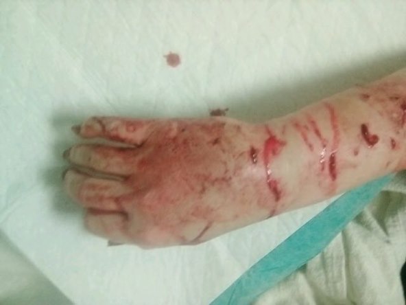 KRV JE ŠIKLJALA Playboyevu zečicu izgrizli njeni vlastiti pitbulli