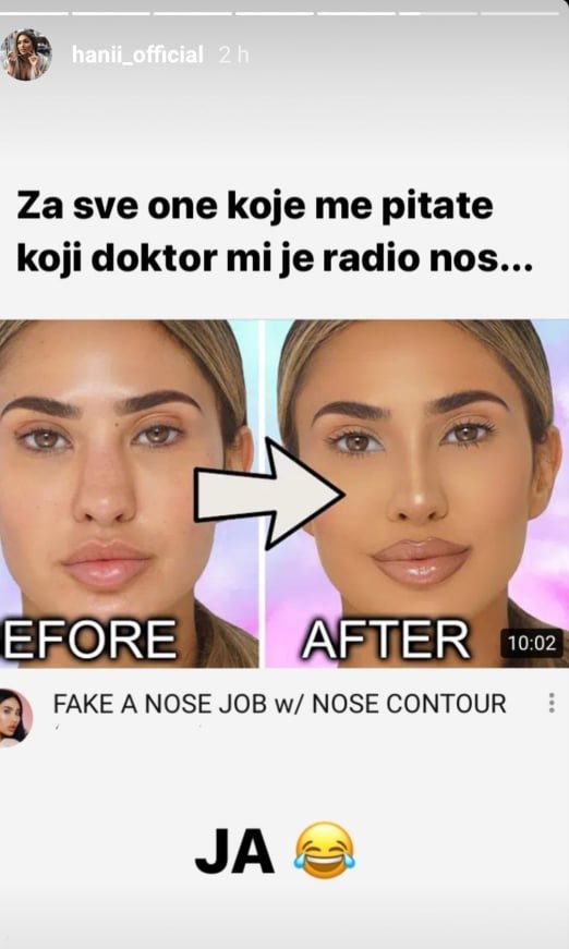 Hana Rodić progovorila o operaciji nosa