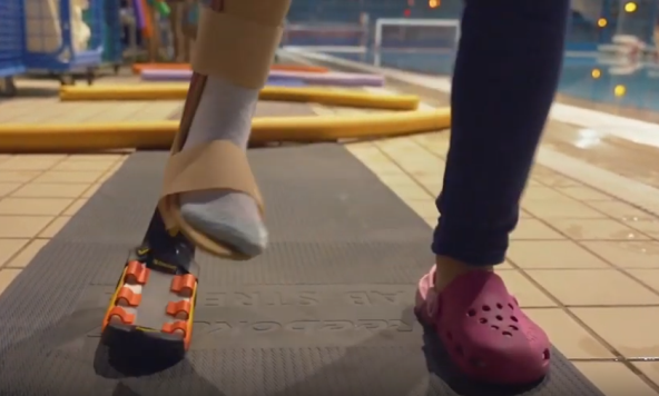 Trkači osigurali aktivne proteze djeci s  oštećenjem donjih ekstremiteta