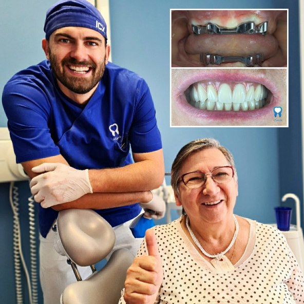 Što je kompletna oralna rehabilitacija?