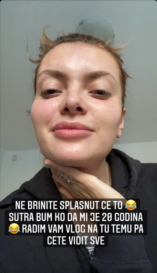 Ella Dvornik ponovno se 'uljepšala': 'Ne brinite, splasnut će to'