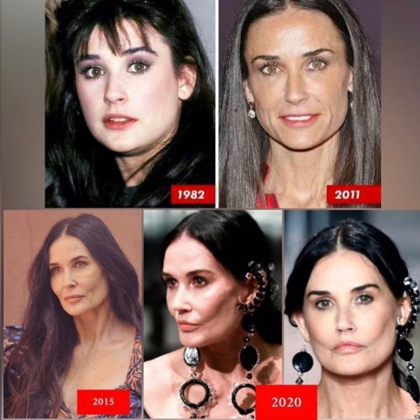 demi moore plastična operacija