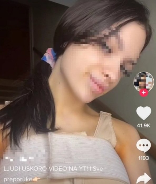 POHVALILA SE Maloljetna srpska influencerica povećala grudi