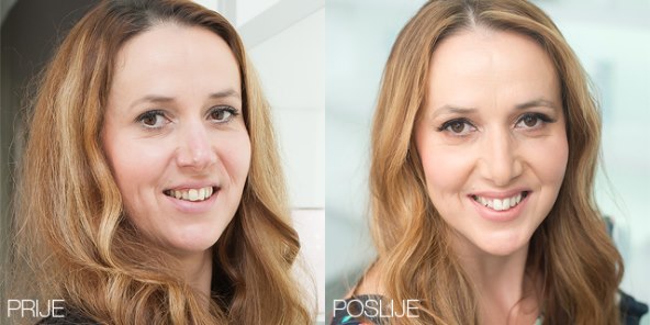 Dojmovi dobitnice 'Beauty makeovera' Poliklinike Bagatin: 'Sve bih ponovila'
