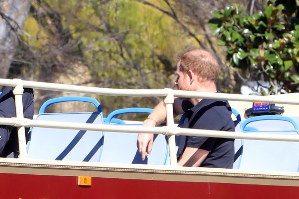 prince harry pati zbog ćelavosti