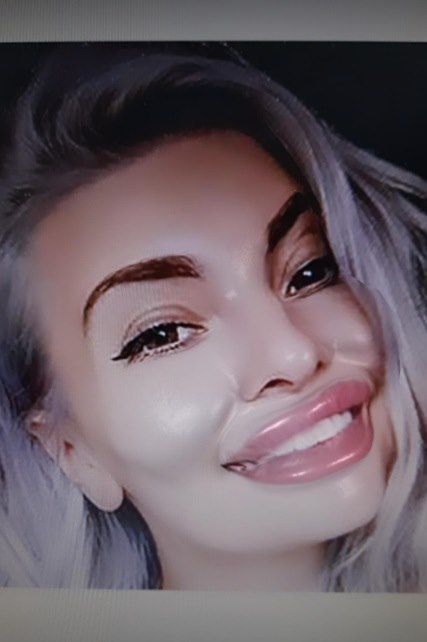 kad bi slavni pretjerali s estetskim operacijama foto