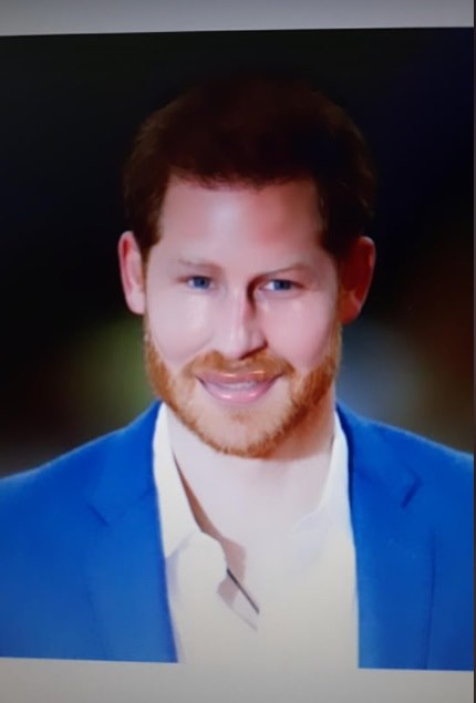 kad bi slavni pretjerali s estetskim operacijama foto