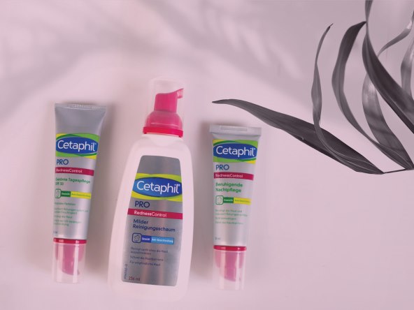 'Rumeno je zdravo, crveno nikako! Lice mi se napatilo, probala sam sve...'