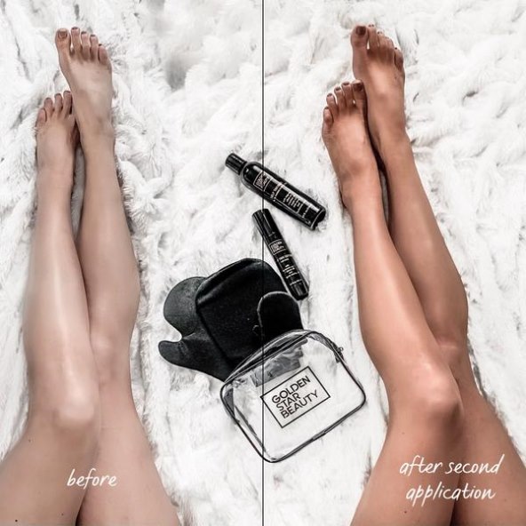 Kako do preplanulog tena bez štetnog izlaganja suncu i oštećenja kože?