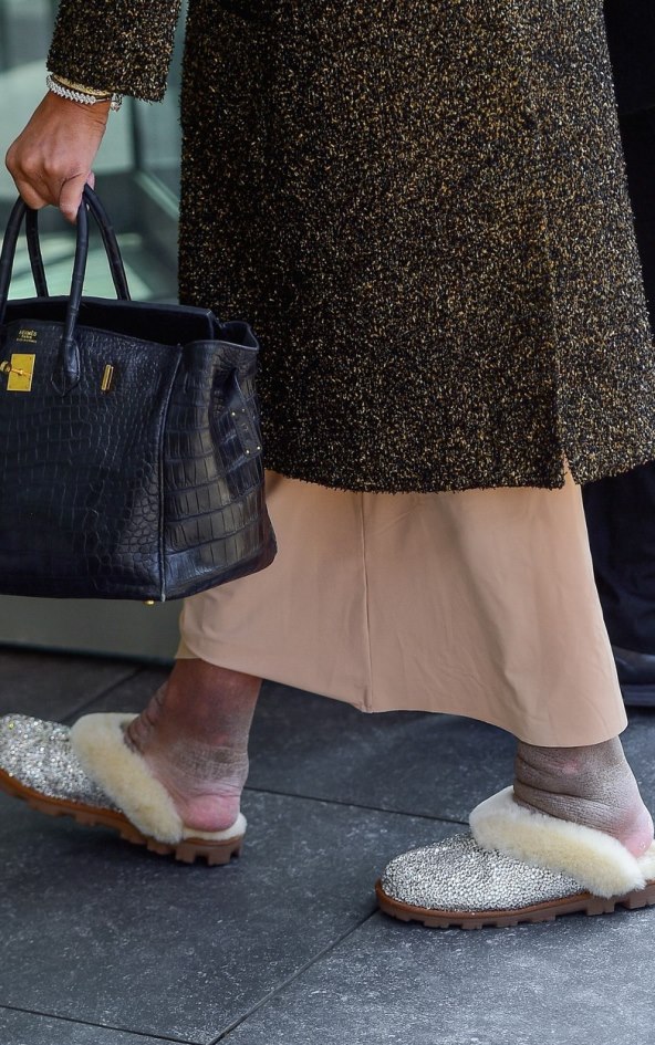 Wendy Williams već neko vrijeme boluje od limfedema