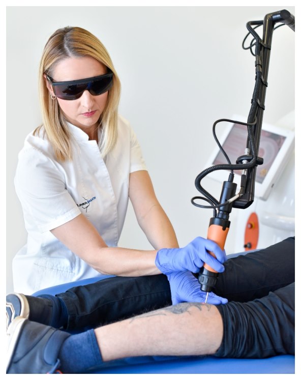 uklanjanje tetovaže laserom u Poliklinici Bagatin