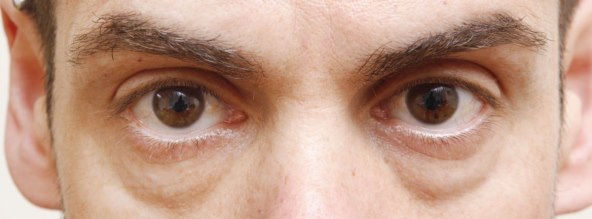 veliko-zbogom-podocnjacima