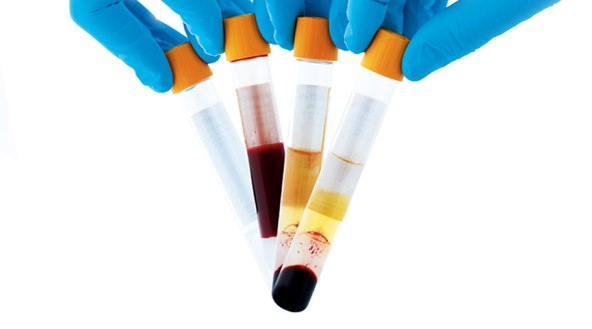 pomladivanje-maticnim-stanicama-pokazalo-zavidne-rezultate