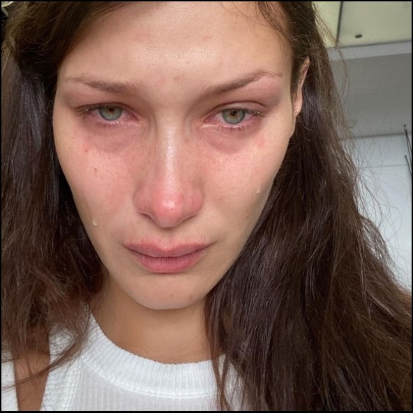 Bella Hadid imala je mnogo živčanih slomova koji su utjecali na njezino psihičko zdravlje