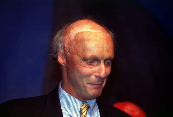 Niki Lauda