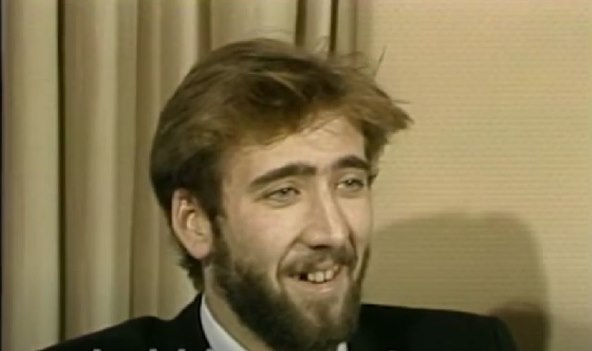 Nicolas Cage imao je loše zube