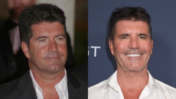 Slavni botoksirani muškarci