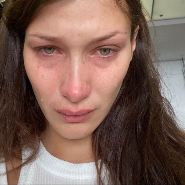 Bella Hadid ima psihičkih problema