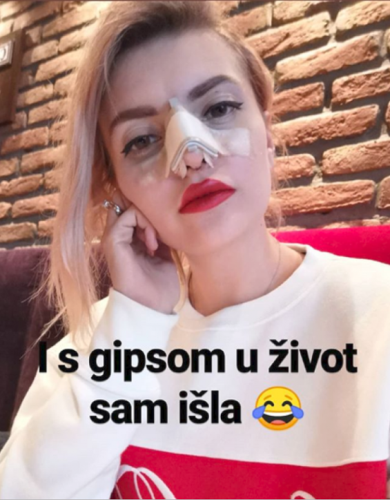 Ella Dvornik: 'Govorili su i prije da sam plastična, sad sam to potvrdila'
