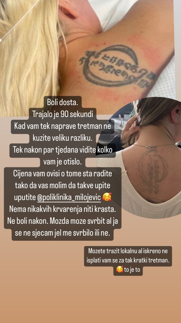 Ella Dvornik uklonila tetovažu