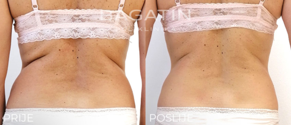 Adipologije prijeposlije.png