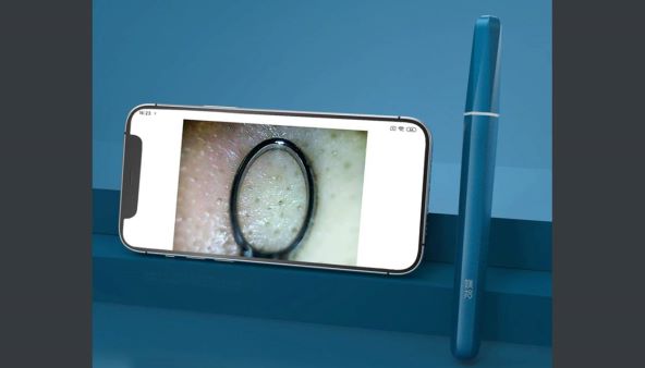Xiaomi Meishi čistač pora 2