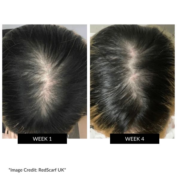 CurrentBody Skin LED Hair Regrowth Device (3).jpg