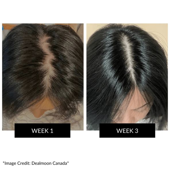 CurrentBody Skin LED Hair Regrowth Device (2).jpg