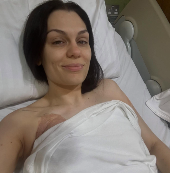 Jessie J