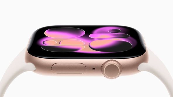 Apple Watch Series 11.jpg