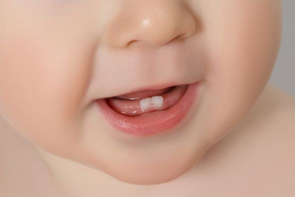 Kojim redoslijedom rastu zubi i kako ublažiti bol?