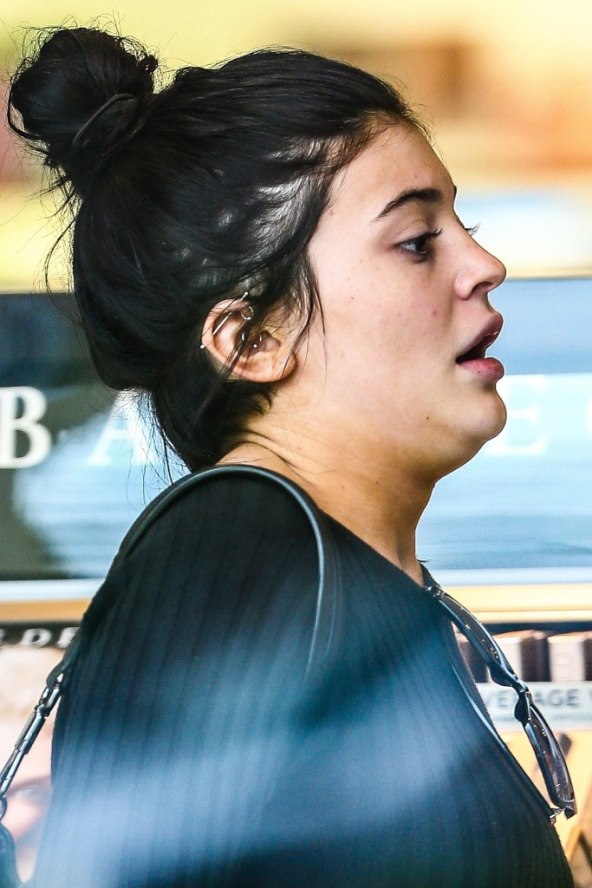 ...A IMAJU SVU NJEGU SVIJETA Poznate ljepotice koje muku muče s (jako) lošim tenom