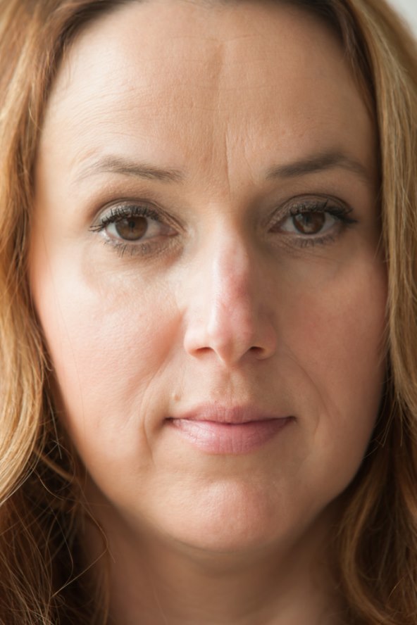 Poliklinika Bagatin i Story predstavljaju prvu „Beauty makeover“ kandidatkinju