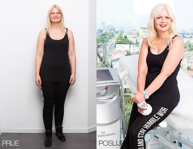 Poliklinika Bagatin i Story predstavljaju treću makeover pobjednicu