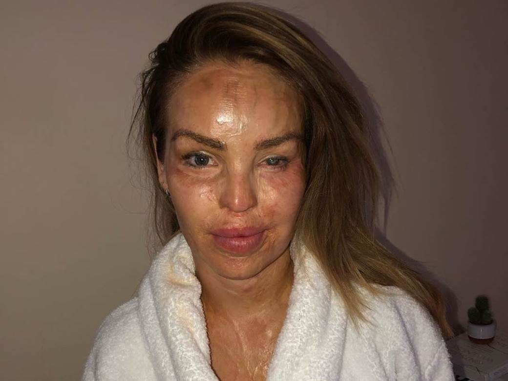 Katie Piper