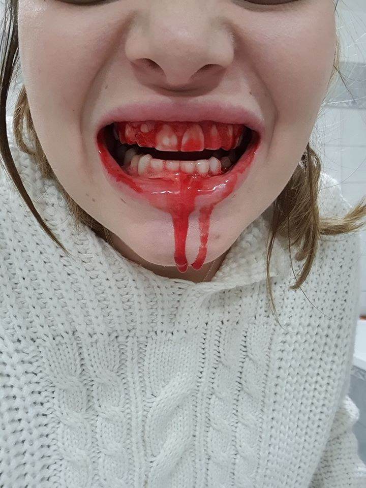 Ella Dvornik krvavom fotografijom uznemirila Britance
