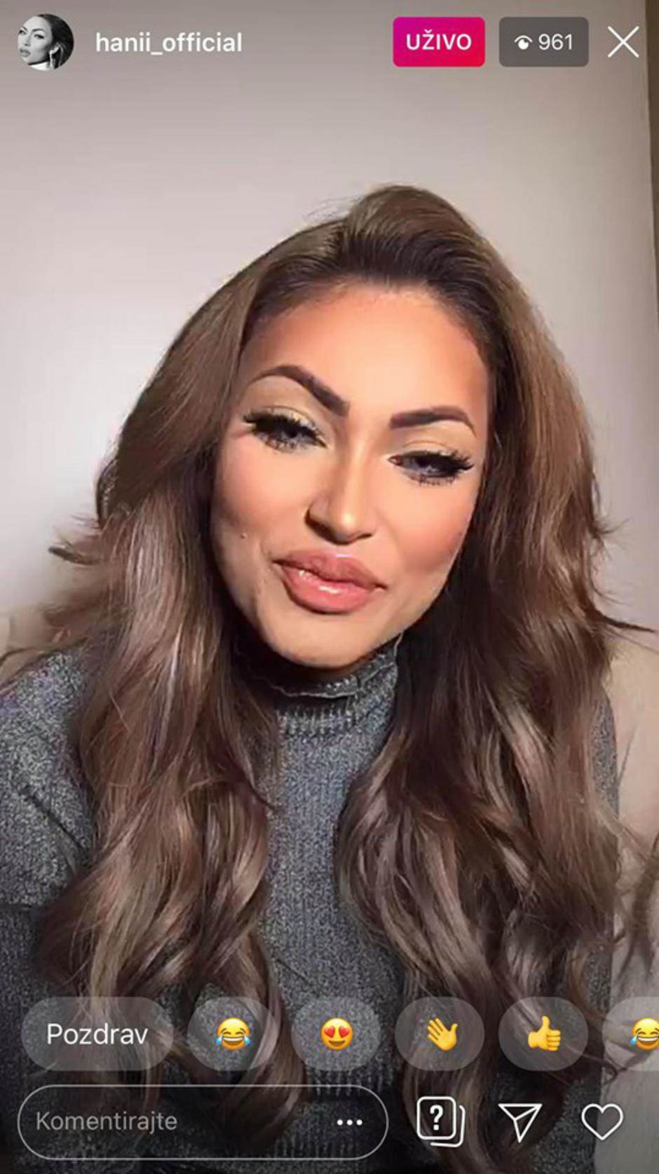 Hana Rodić priznala što je sve na sebi promijenila