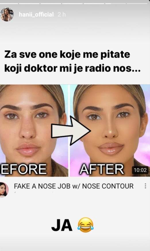 Hana Rodić progovorila o operaciji nosa