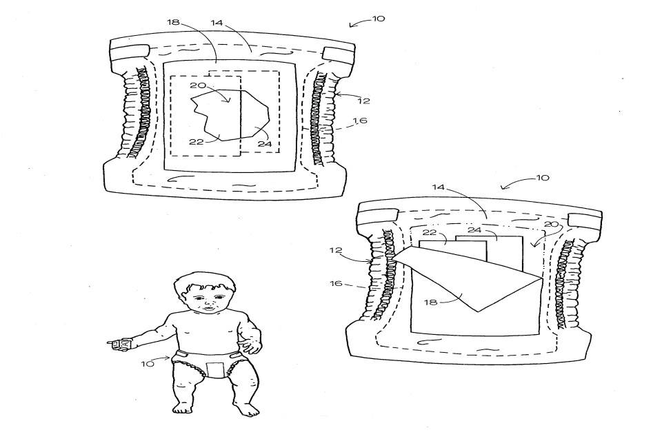 US4753647-drawings-page-2