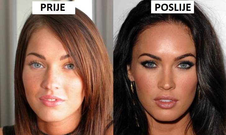 Megan Fox promijenila je izgled operacijama