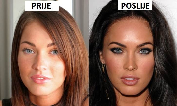 megan fox prije i poslije operacija