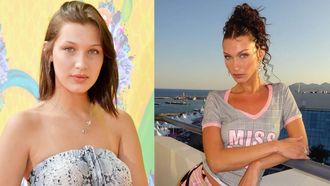 Bella Hadid promijenila je izgled plastičnim operacijama