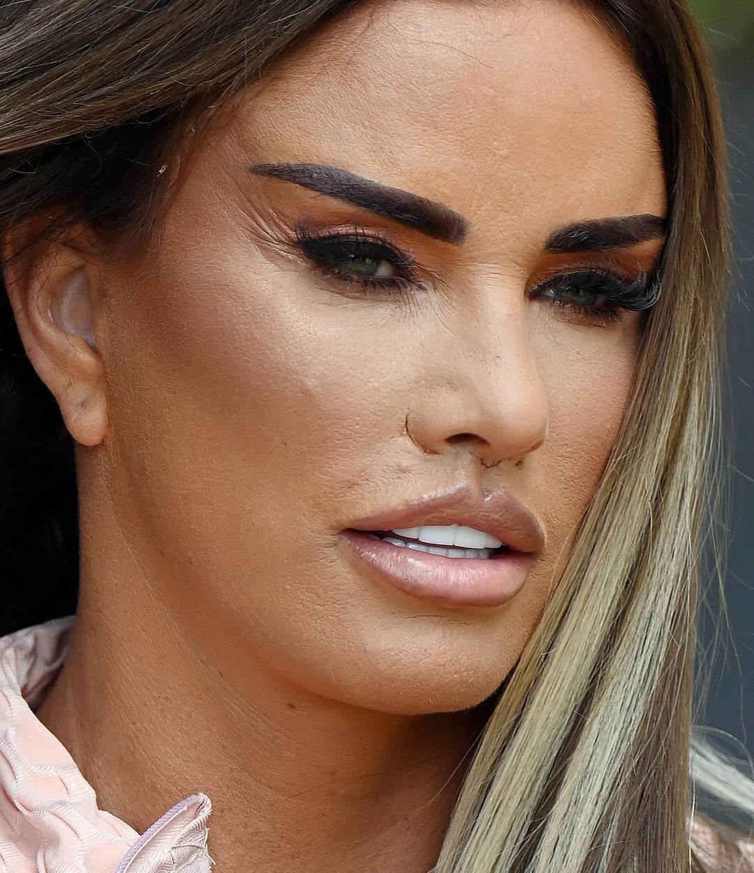 Katie Price se uništila plastičnim operacijama