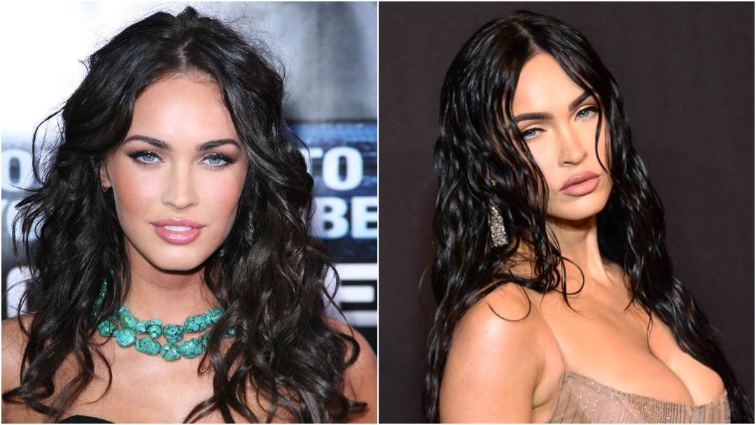 Megan Fox transformirala je svoj izgled plastičnim operacijama