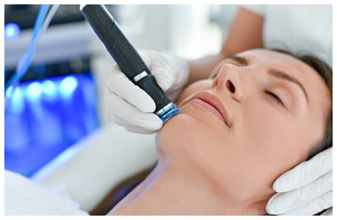 HydraFacial tretman u Poliklinici Bagatin