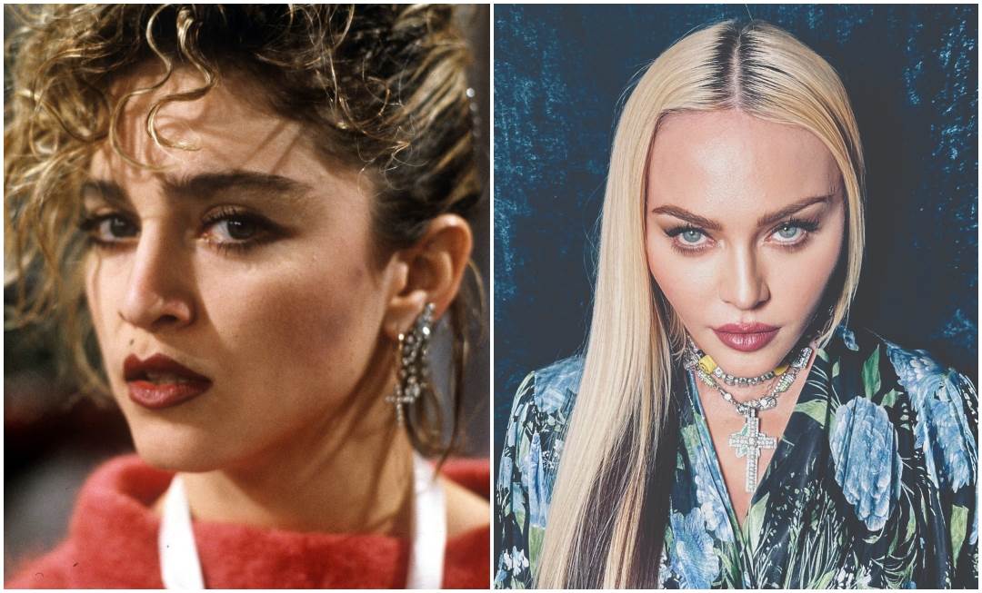 Madonna je uništila izgled plastičnim operacijama